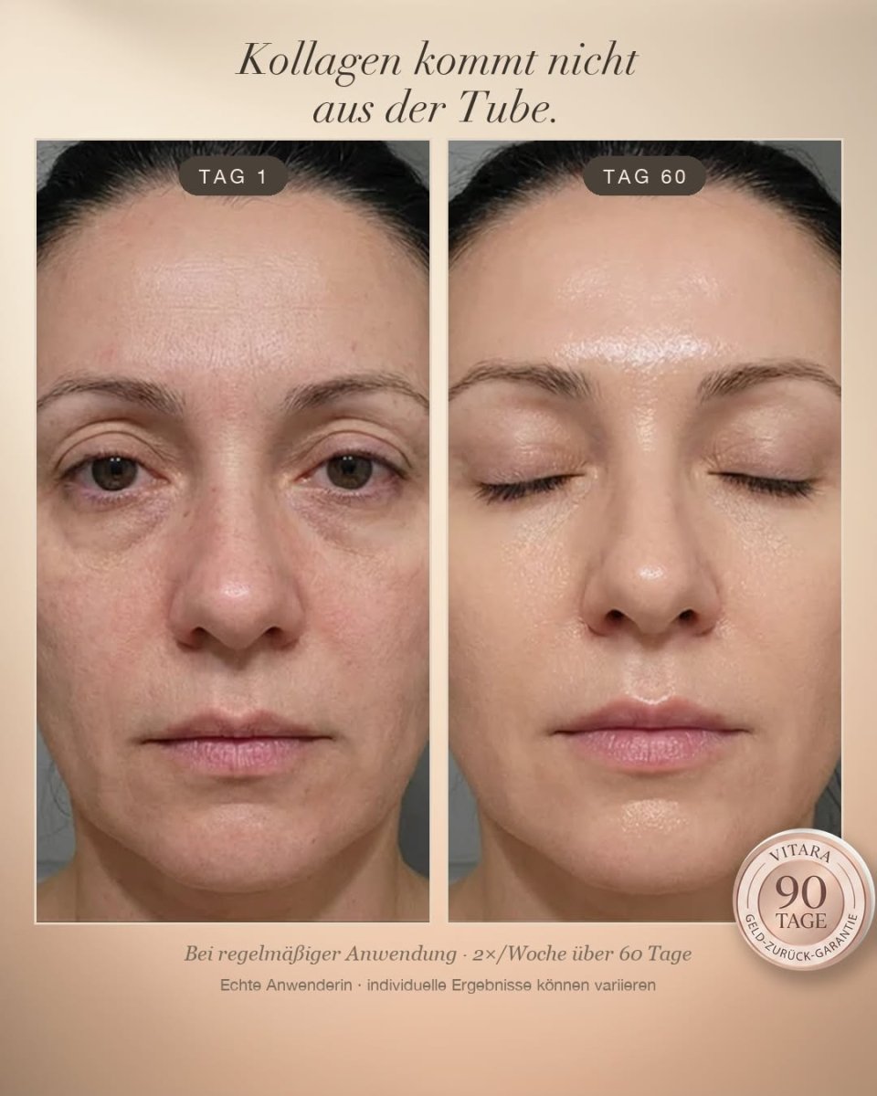 Vitara Skin – Micro-Needling Infusion Set für Zuhause - Vitara Skin | Micro-Needling Infusion für Zuhause!