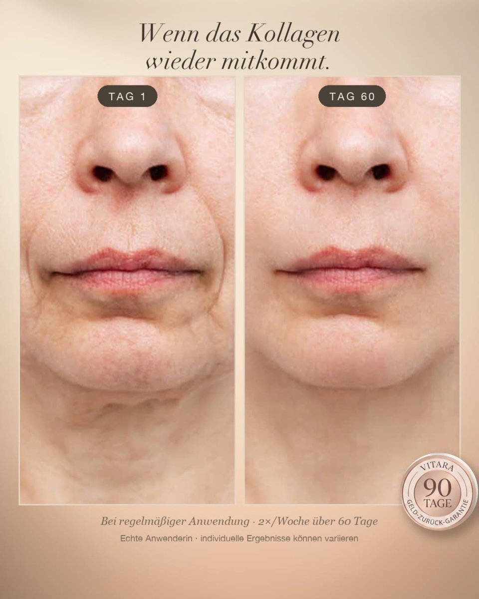 Vitara Skin – Micro-Needling Infusion Set für Zuhause - Vitara Skin | Micro-Needling Infusion für Zuhause!