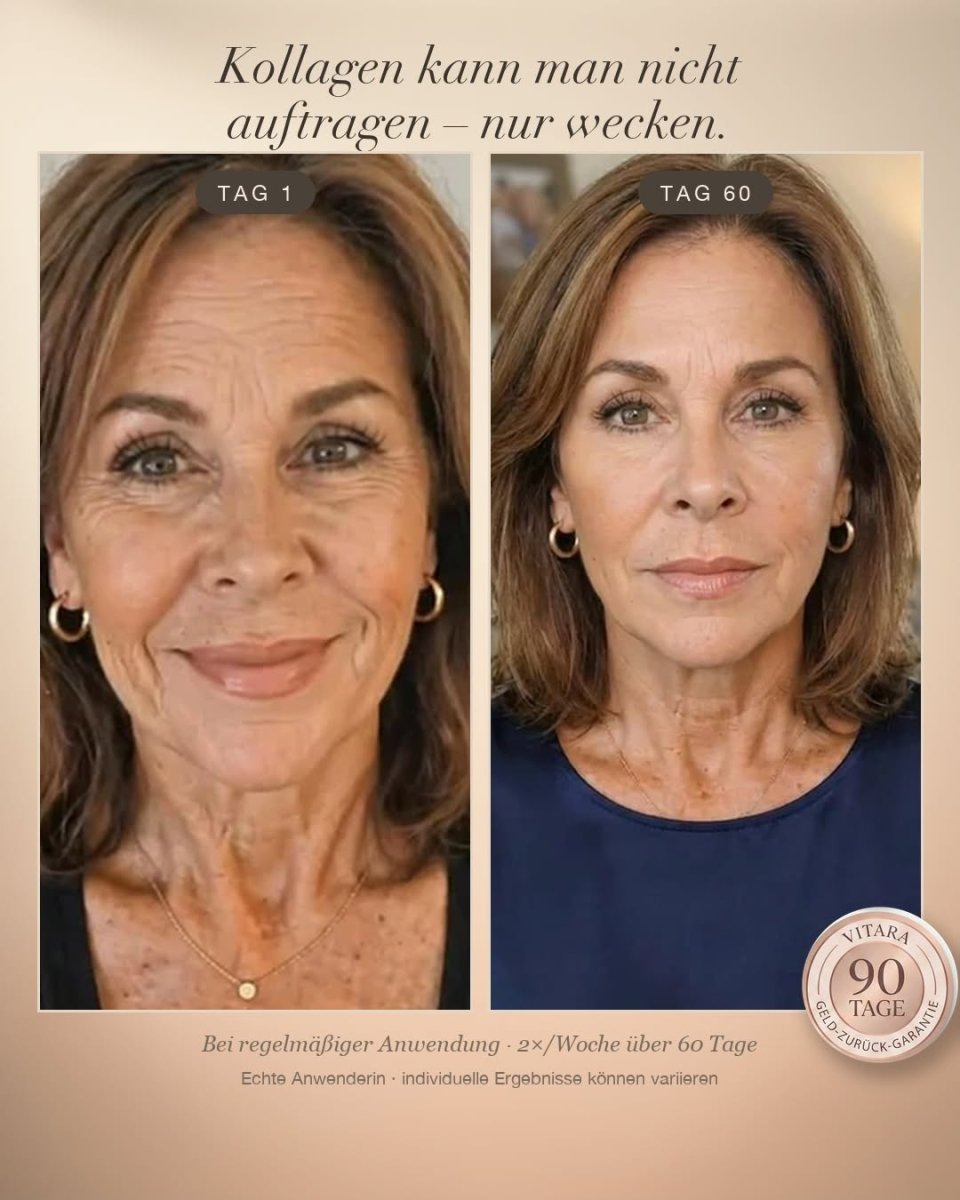 Vitara Skin – Micro-Needling Infusion Set für Zuhause - Vitara Skin | Micro-Needling Infusion für Zuhause!